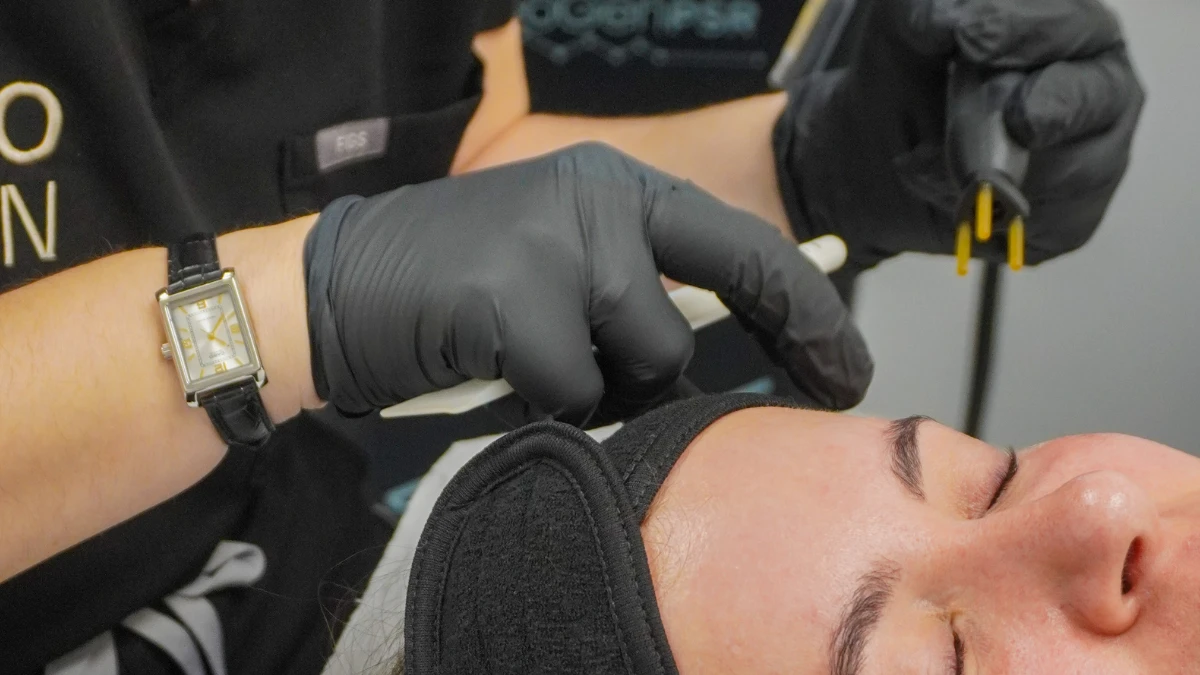 neogen-plasma-forehead-procedure